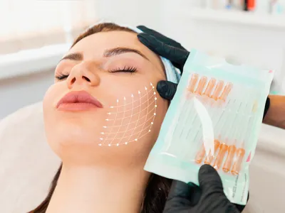 Thread Lift