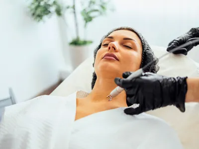 Mole Removal