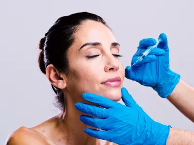 Dermal Fillers