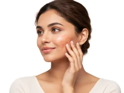 Microneedling